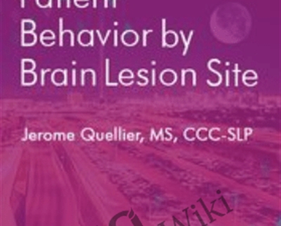 Predicting Patient Behavior by Brain Lesion Site - BoxSkill - Get all Courses