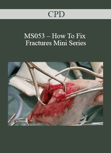 Purchuse CPD - MS053 – How To Fix Fractures Mini Series course at here with price $479 $114.