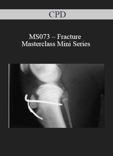Purchuse CPD - MS073 – Fracture Masterclass Mini Series course at here with price $479 $114.