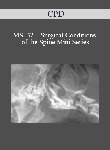 Purchuse CPD - MS132 – Surgical Conditions of the Spine Mini Series course at here with price $479 $114.