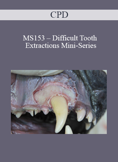 Purchuse CPD - MS153 – Difficult Tooth Extractions Mini-Series course at here with price $479 $114.