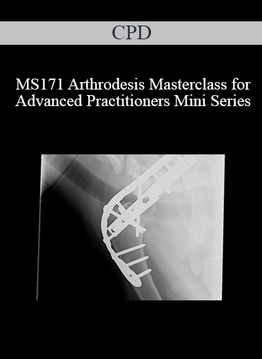 Purchuse CPD - MS171 Arthrodesis Masterclass for Advanced Practitioners Mini Series course at here with price $479 $114.