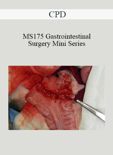 Purchuse CPD - MS175 Gastrointestinal Surgery Mini Series course at here with price $479 $114.