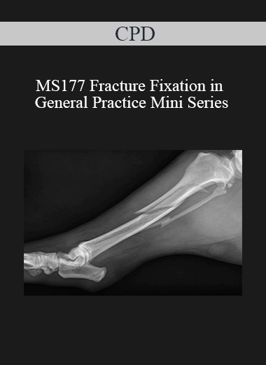 Purchuse CPD - MS177 Fracture Fixation in General Practice Mini Series course at here with price $479 $114.