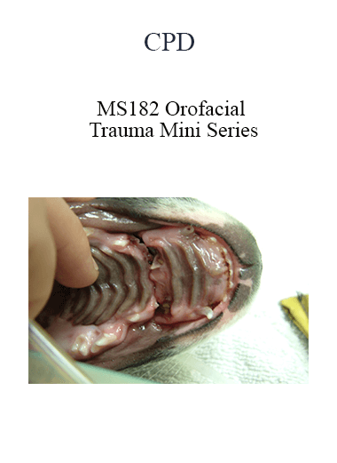 Purchuse CPD - MS182 Orofacial Trauma Mini Series course at here with price $479 $114.