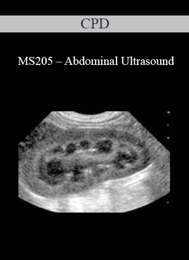 Purchuse CPD - MS205 – Abdominal Ultrasound course at here with price $479 $114.